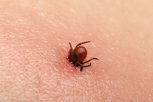 A Lyme-kór bőrtünetének ötös szabálya