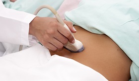 A kismedencei szervek edényeinek ultrahangja (USDG) - Fekélyek 