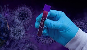 COVID-19 elleni immunitás vizsgálatok