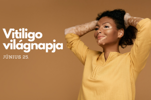 Vitiligo - pigmenthiány
