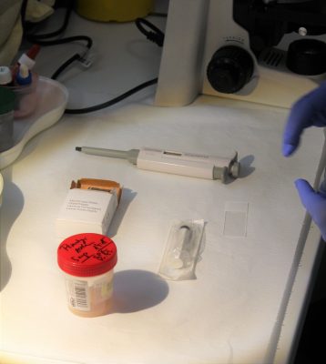 férfi termékenység vizsgálat