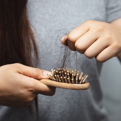 foltos hajhullás alopecia areata