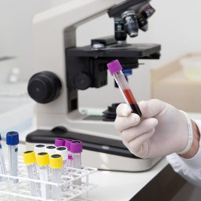 Vérvétel előtti konzultáció laboreredmény kiértékelés