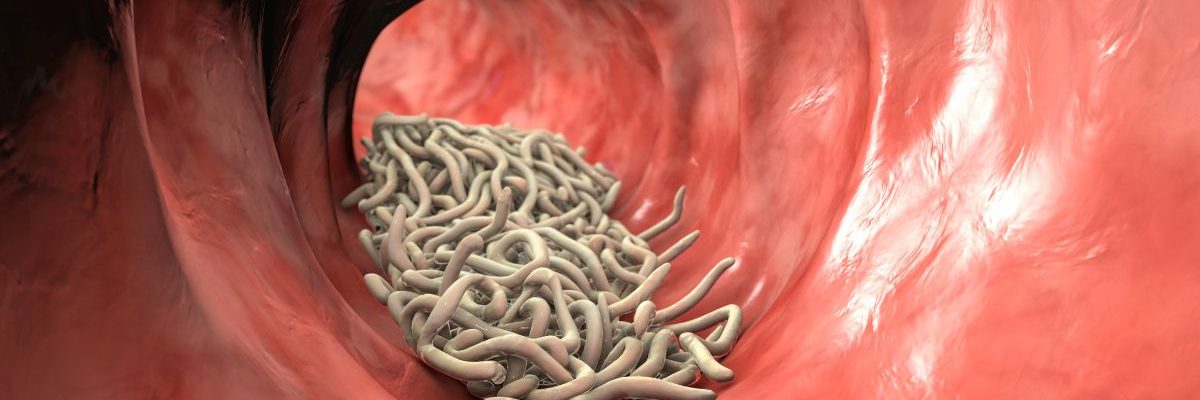 Bélféreg, paraziták